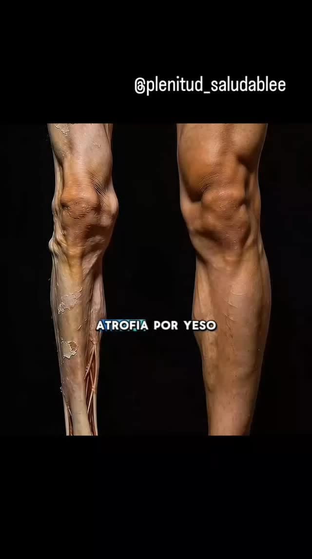 #habitossaludables #ejerciciofisico #atrofiamuscular