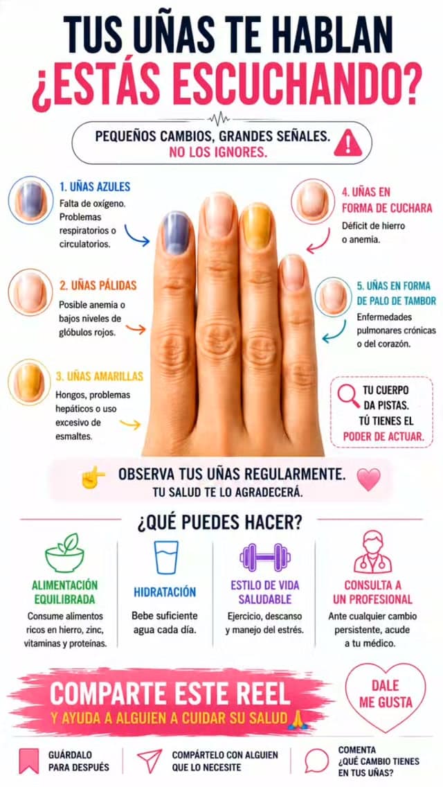 ¿Sabías que tus uñas pueden dar pistas sobre tu salud?
Observa estos 5 cambios y, si alguno persiste, consulta con un profesional.
Guarda este Reel y compártelo con quien pueda resultarle útil.
¿Has observado alguno? Te leemos.